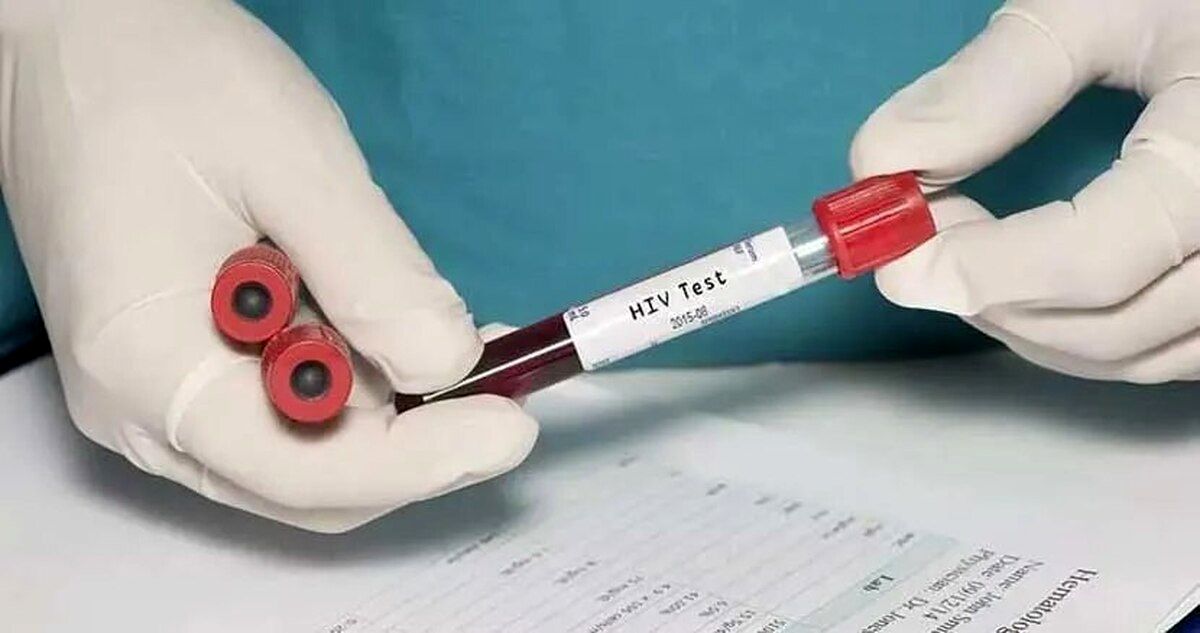 آیا لیزر باعث انتقال HPV می شود؟