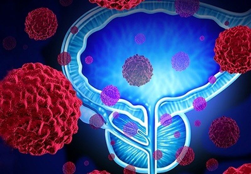 بهترین غذاها برای پیشگیری از سرطان پروستات